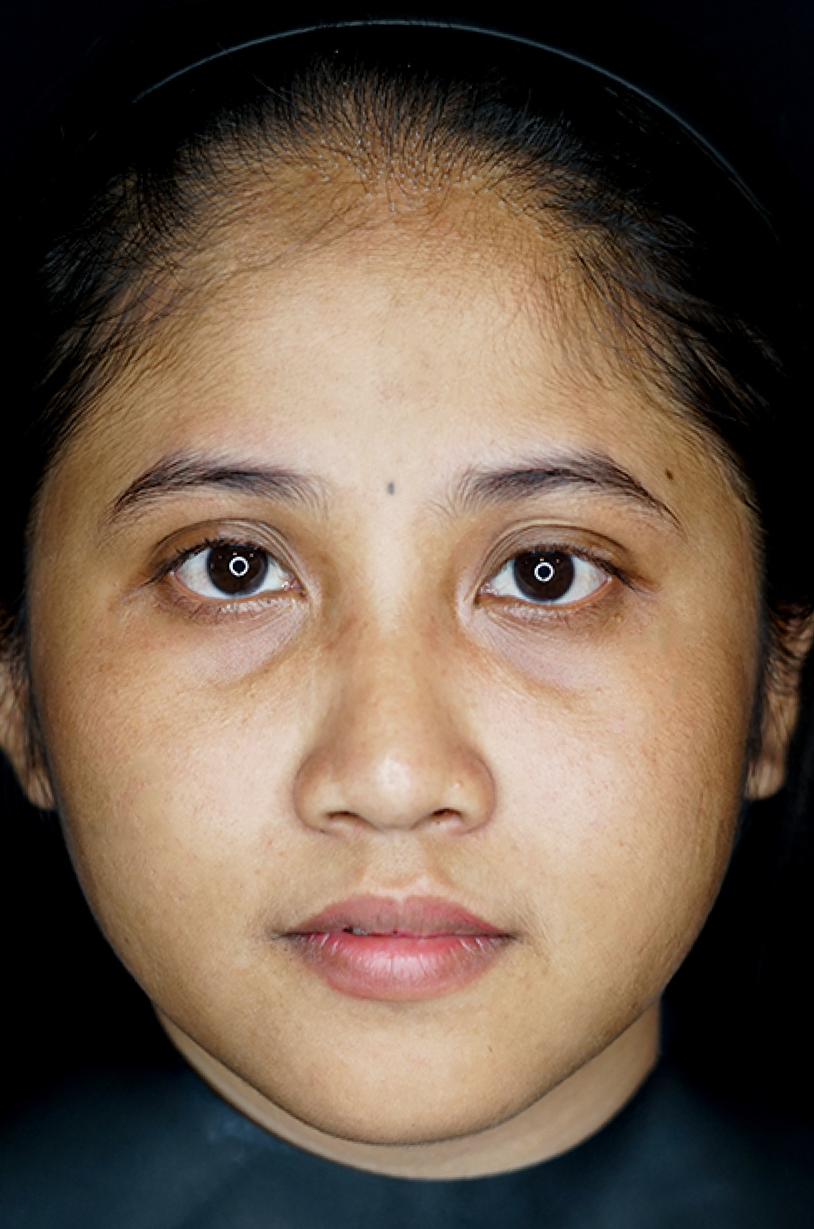 Photo Laser Blackdoll After