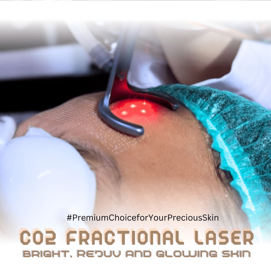C02 Laser