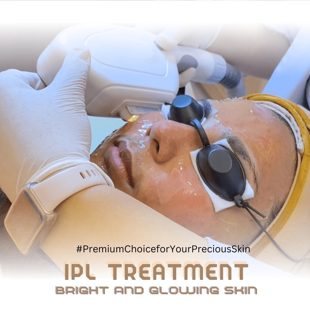 IPL Treatment