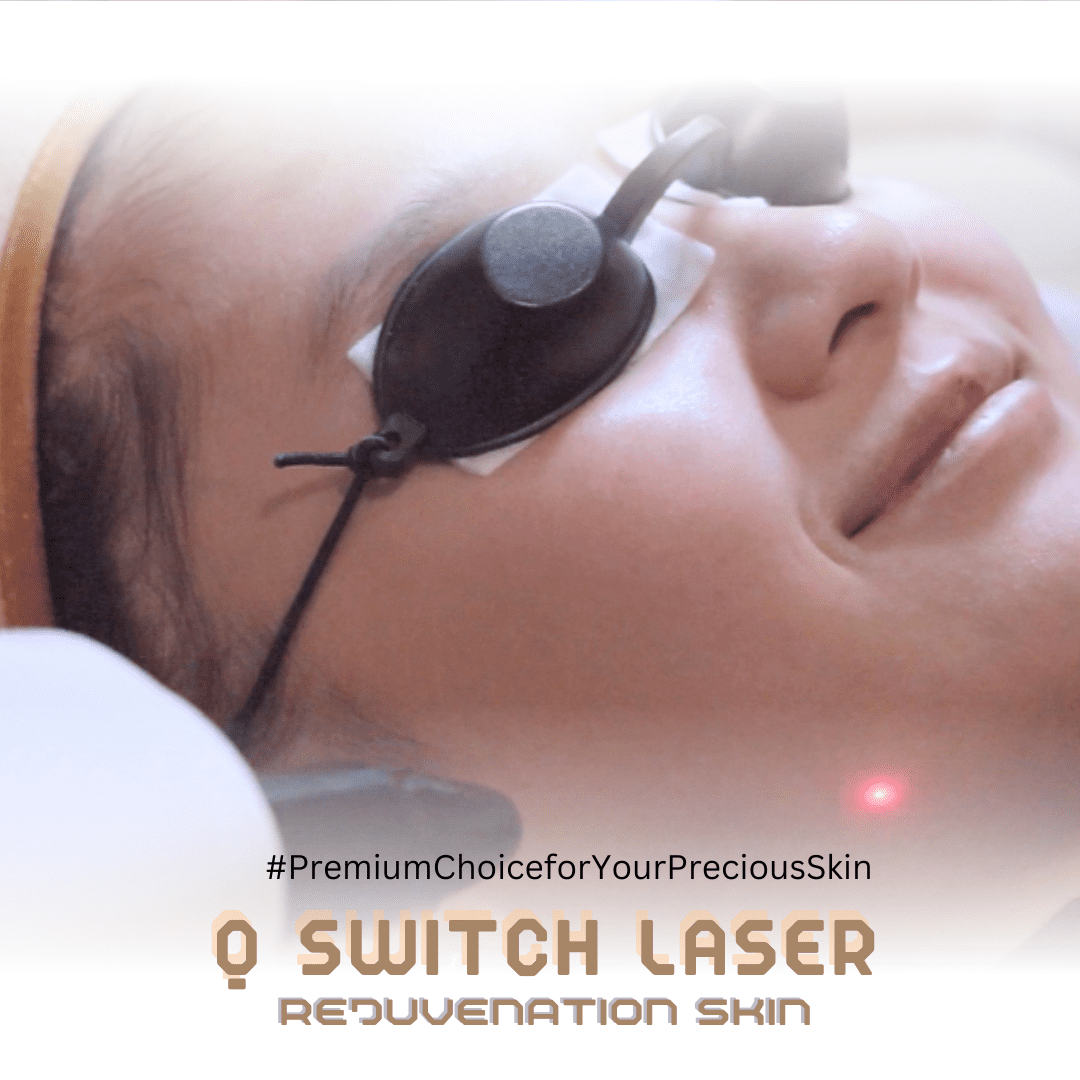 Q Switch Laser