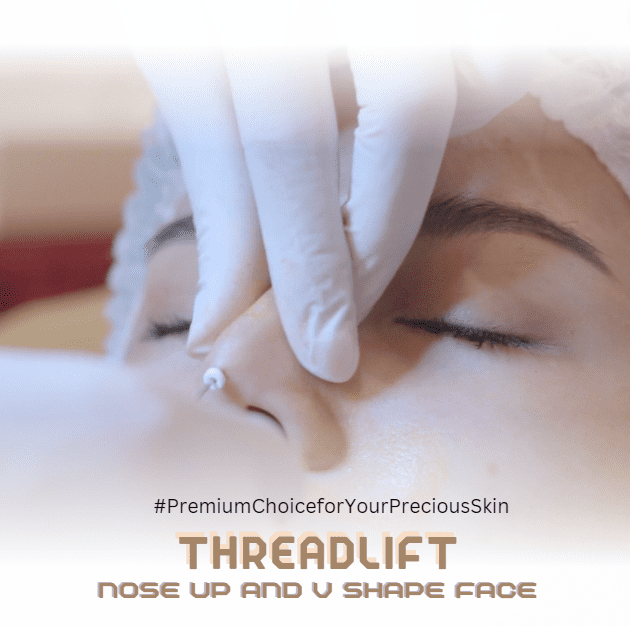 Threadlift Treatment