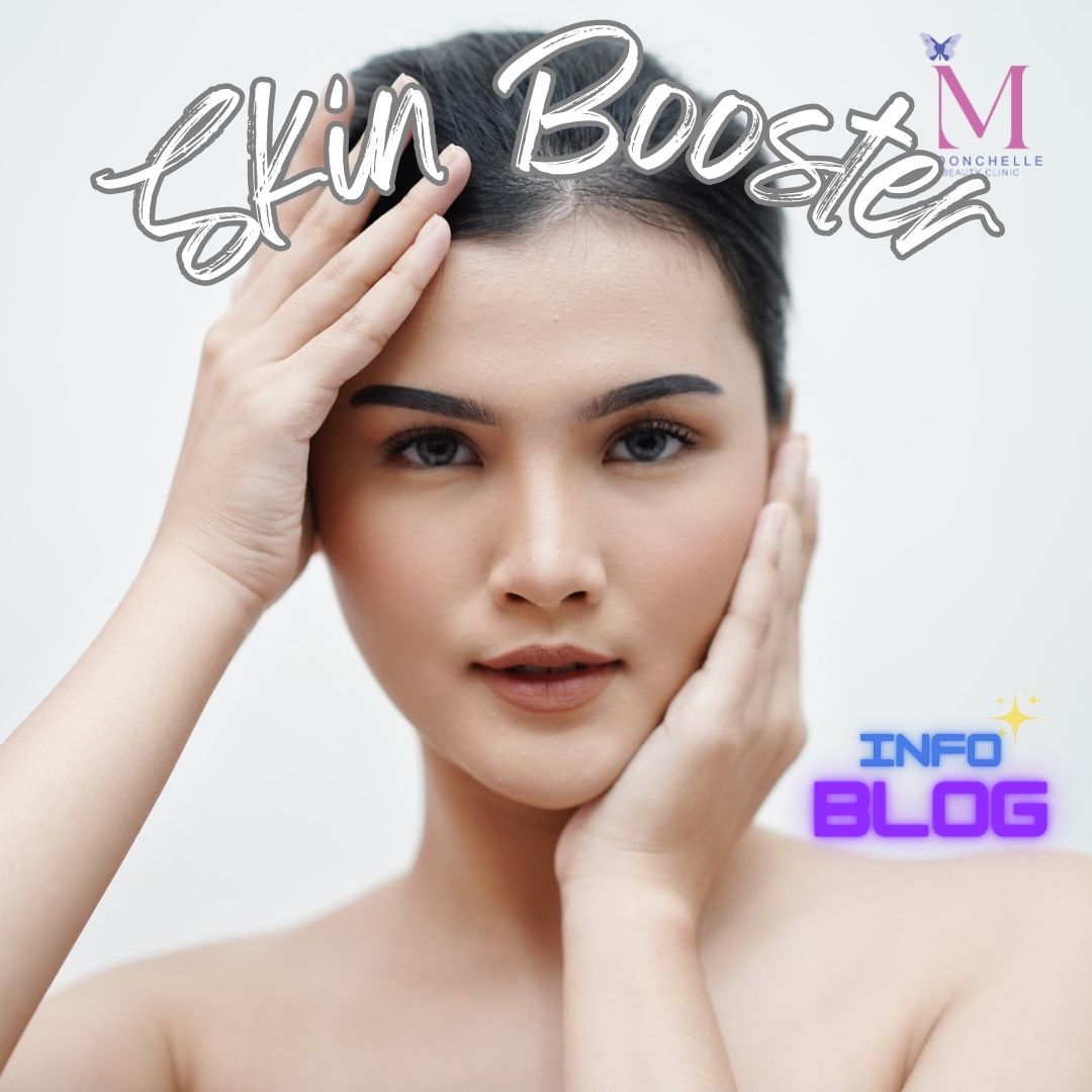Blog-img