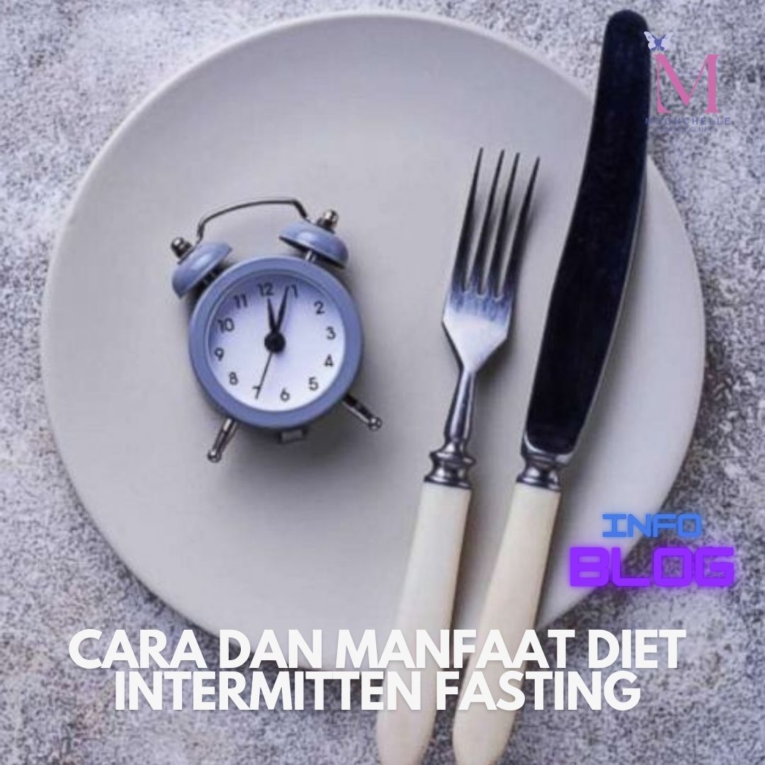 Blog-img