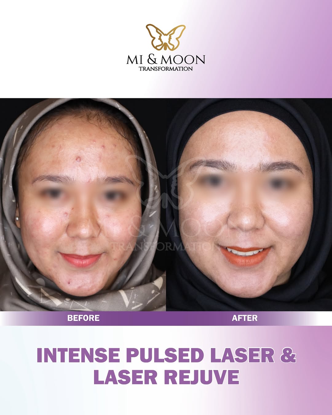 Klinik Kecantikan Surabaya Barat Moonchelle Beauty Clinic