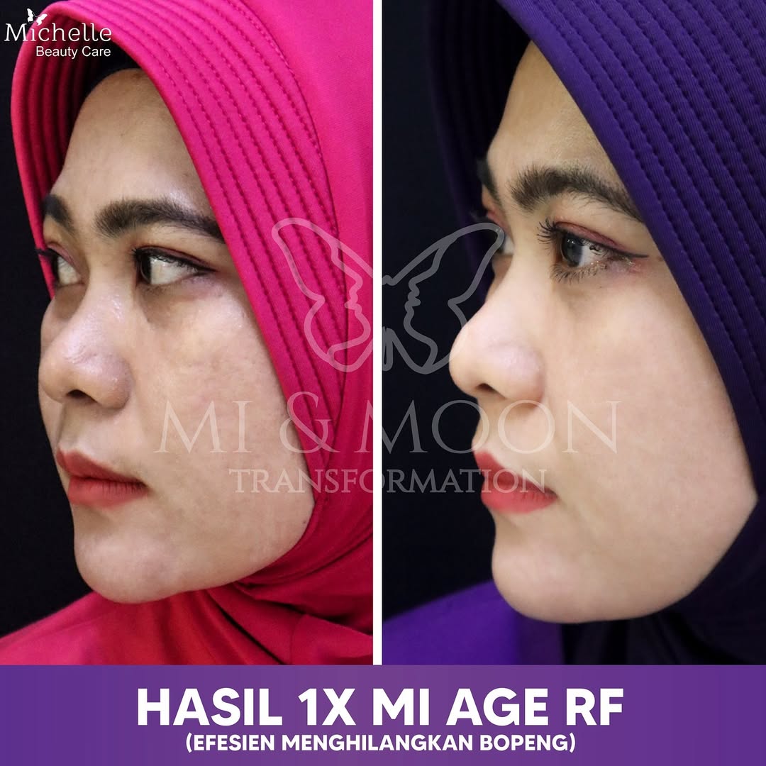 Klinik Kecantikan Surabaya Barat Moonchelle Beauty Clinic