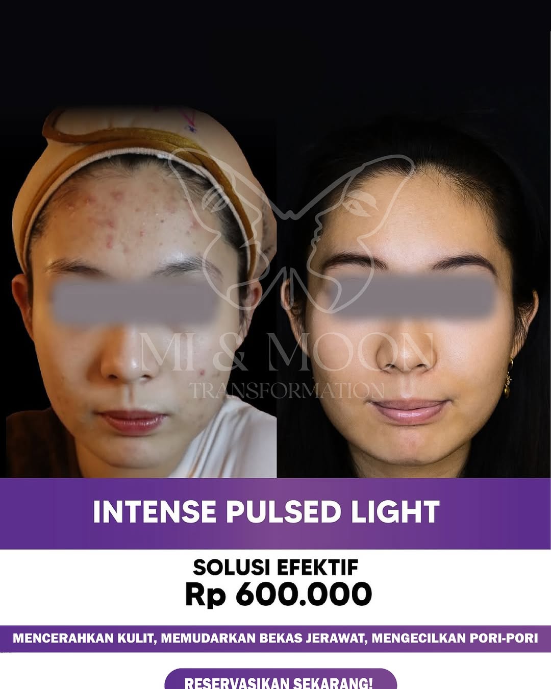 Klinik Kecantikan Surabaya Barat Moonchelle Beauty Clinic